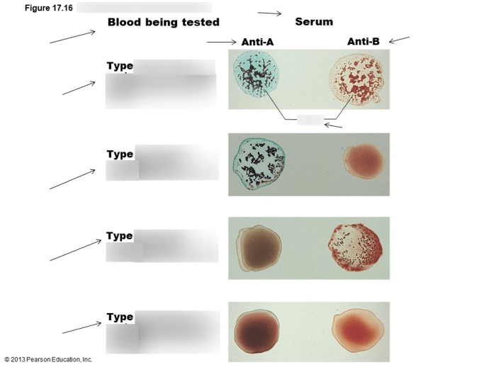 Abo blood test group grouping reagent antisera typing ab 2010